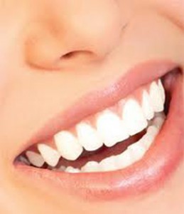 White fillings tooth restoration Sarasota FL