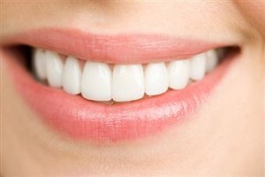 Professional teeth whitening in Sarasota Florida